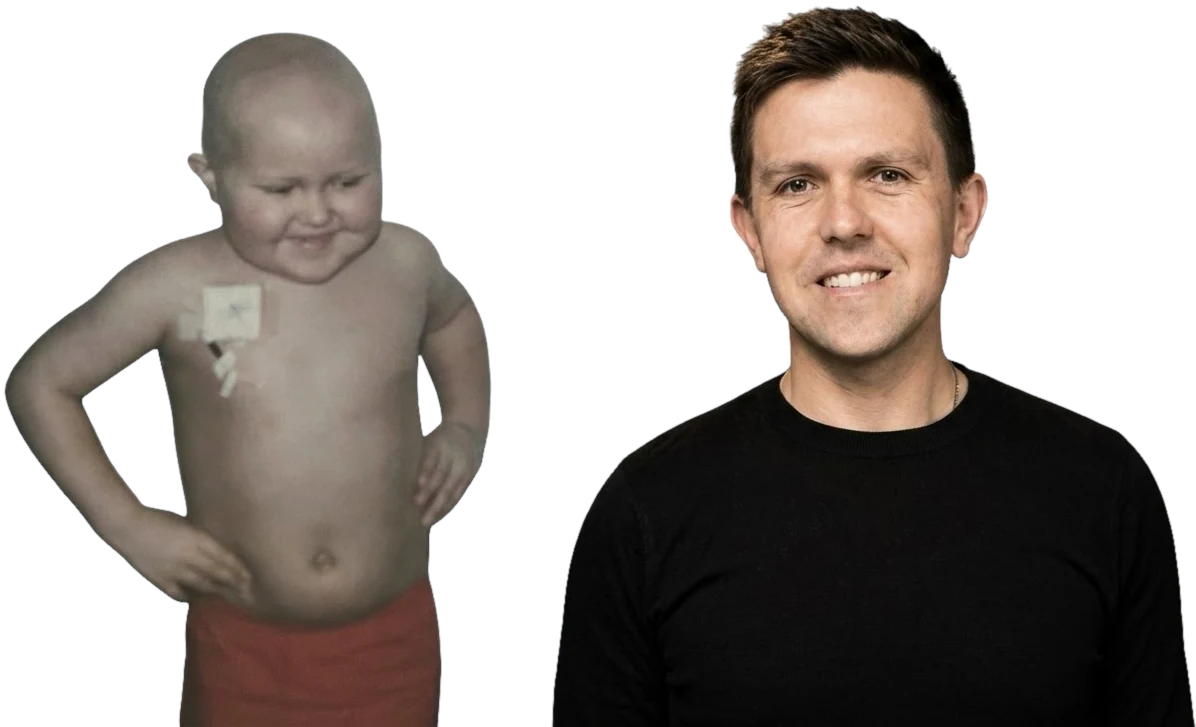 Chris as a child during cancer treatment, next to Chris today